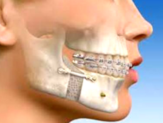 Maxillofacial