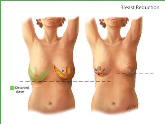 Onco Reconstructive